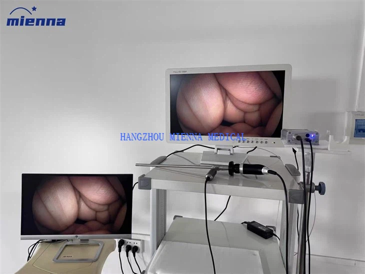 Full HD SDI Endoscopy System/Ear-picking Endoscopy Camera/Pet Industrial Endoscopy Camera