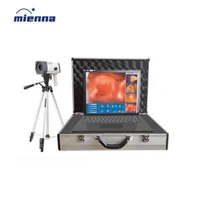 Jarrohlik ginekologiya raqamli elektron kolposkop